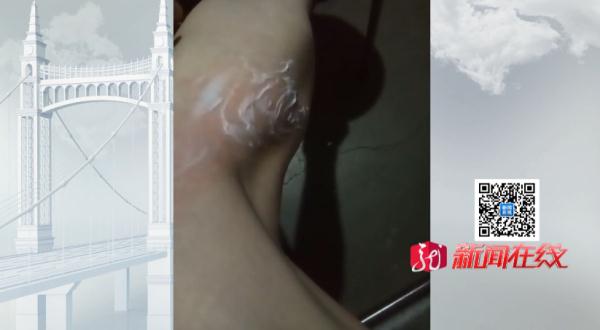 紧急提醒！已有3人死亡！这种虫子，黑龙江常见！