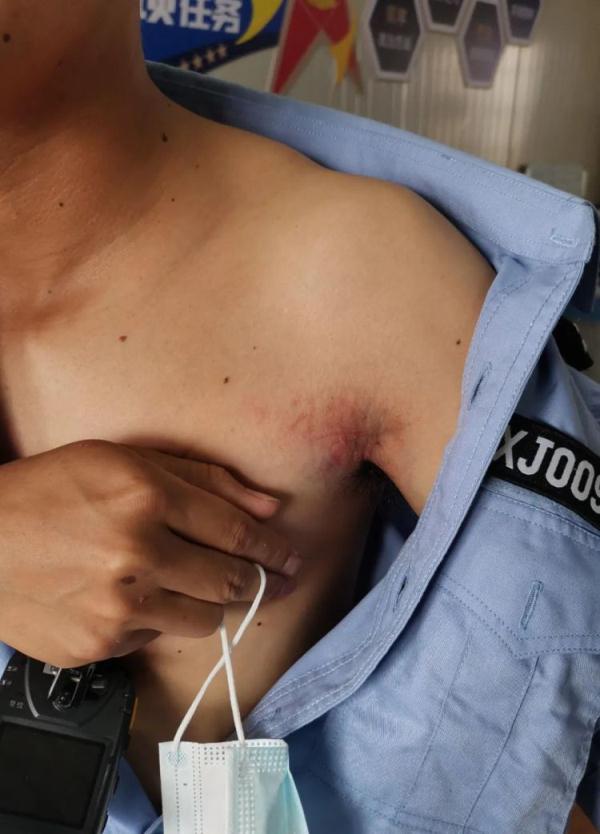一男子“拖着交警”冲卡，被逼停还弃车逃跑，竟是因为怕…