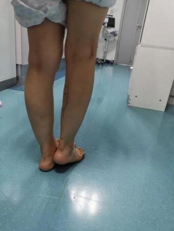 腿实在瘦不了，p图也比瞎整强