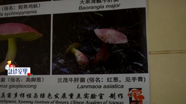 看见烟花、彩虹？医院陆续接诊菌中毒患者，医生建议......