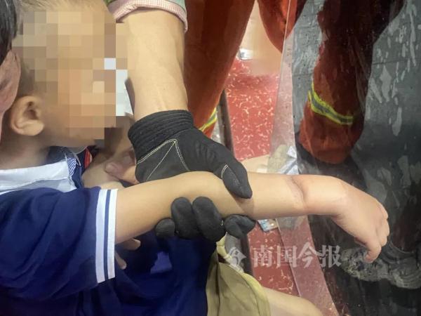 看着都疼!柳州幼童手臂都凹了,小心这些地方“吃小孩” 看着都疼!柳州幼童手臂都凹了,小心这些地方“吃小孩”