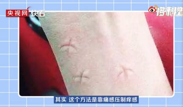 包越大越毒？这些关于蚊子的传说都当真？