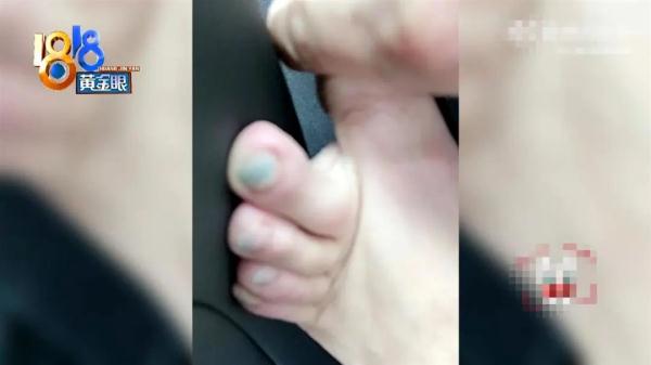 男子花8450元买LV鞋，雨天穿出门，袜子、脚趾全绿了！