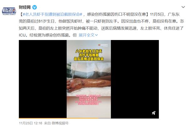 生吃三文鱼险丧命 感染了什么细菌这么吓人
