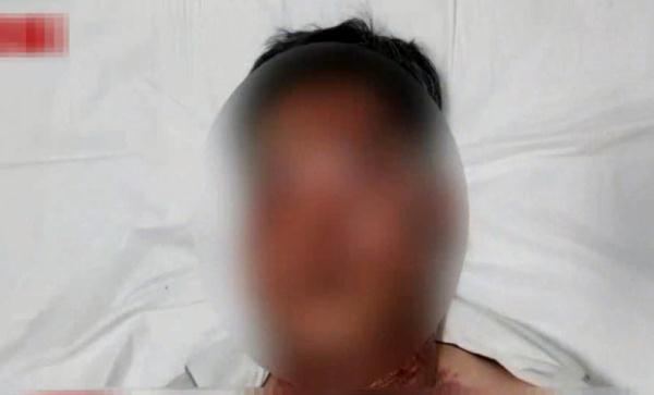 厕所炸了！男子被大面积灼伤，就因为它……