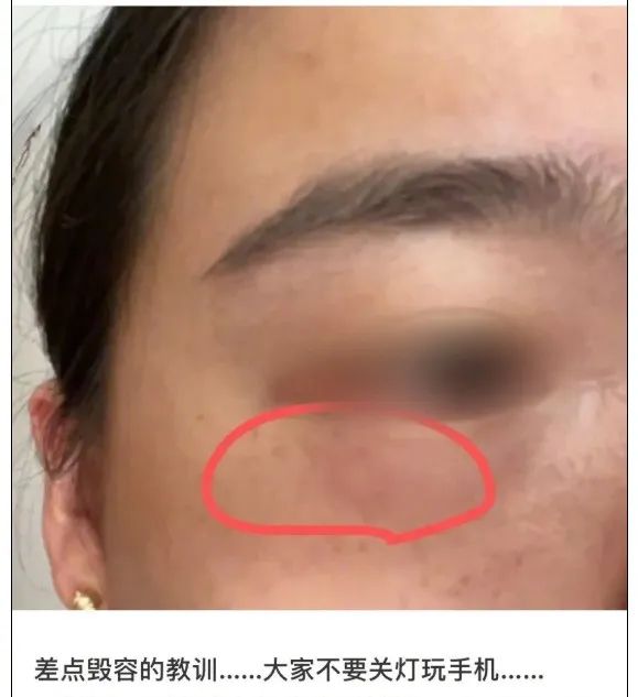 剧毒！遇到这种虫子千万别拍！多人受伤
