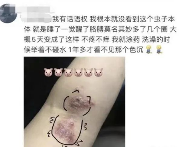 剧毒！遇到这种虫子千万别拍！多人受伤