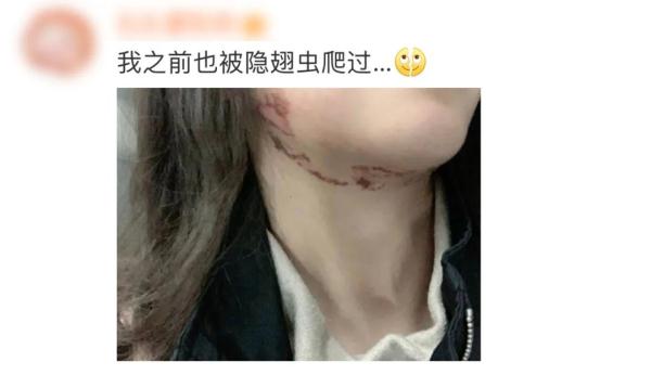 剧毒！遇到这种虫子千万别拍！多人受伤