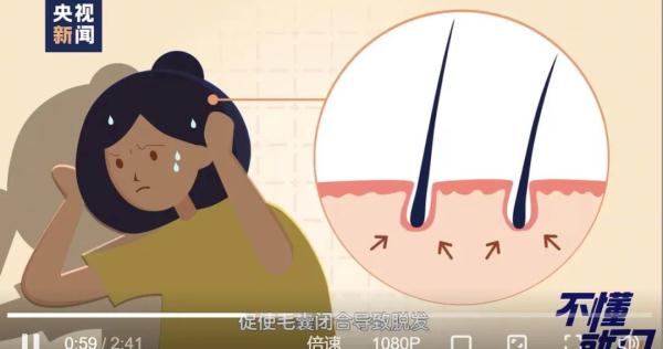 女子怕秃头3个月不洗,结果悲剧了 女子怕秃头3个月不洗,结果悲剧了