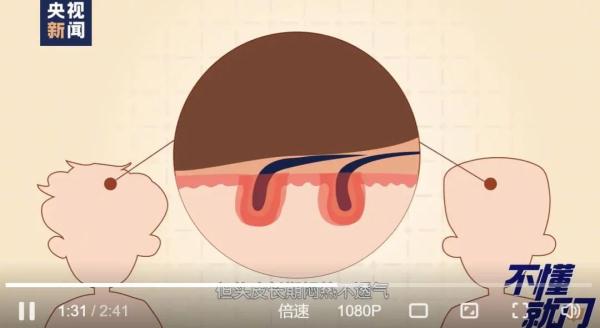 女子怕秃头3个月不洗,结果悲剧了 女子怕秃头3个月不洗,结果悲剧了