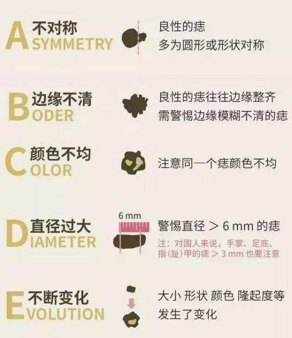 黑痣确诊恶性肿瘤，杭州阿姨后怕不已：差点就晚了！身上这些痣，一定盯紧…