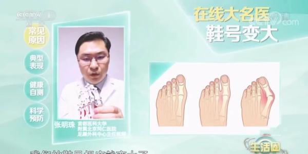 鞋号变大竟是脚部病变的信号？！