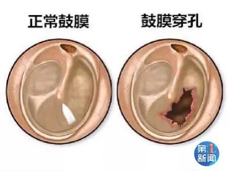 最担心的事发生了！男子打蚊子，一个巴掌下去…惨了