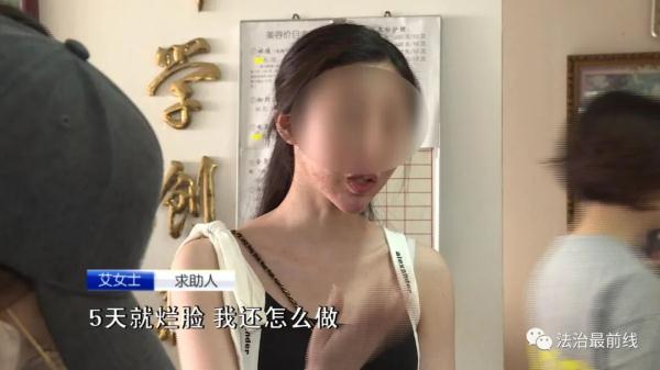 广西20岁美女祛痘不成反“烂脸 ” 要索赔！美容院：放弃治疗后果自负！