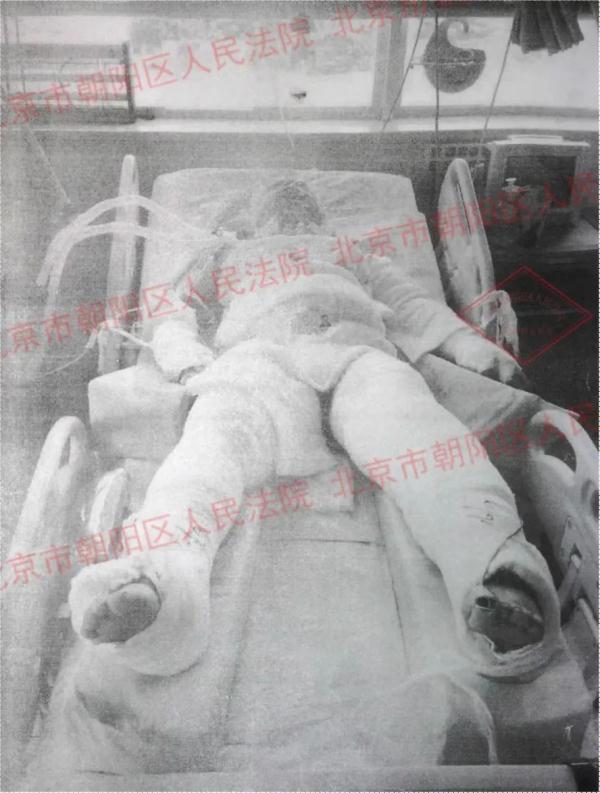 北京一大爷钓鱼时被电伤,命悬一线…法院这么判了! 北京一大爷钓鱼时被电伤,命悬一线…法院这么判了!