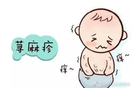 急性和慢性荨麻疹有明显区别 很多人分不清