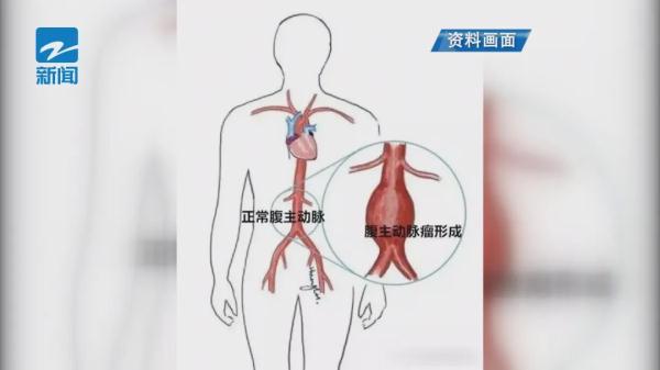 大伯就医意外发现肾脏的“秘密”，从医三十年的医生大呼：第一次见！