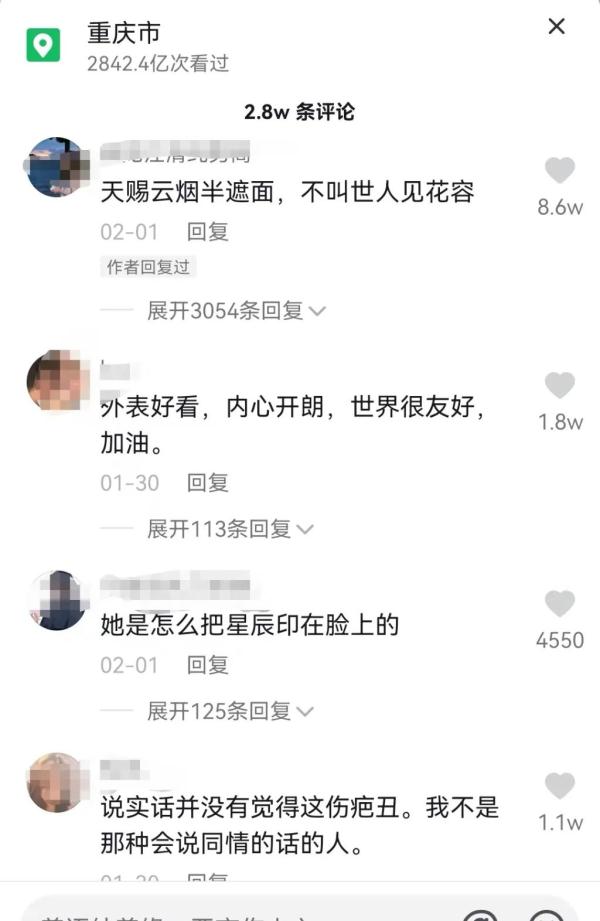 成为自己的太阳 重庆女孩面部烧伤后用笑容治愈网友