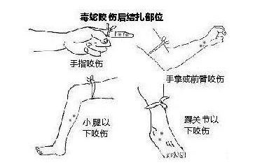 吓人！一条蛇钻进车主电动车头，消防只能把车“扒光”