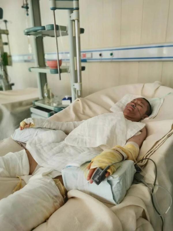 做晚饭时发生意外 19岁女孩重度烧伤 做晚饭时发生意外 19岁女孩重度烧伤