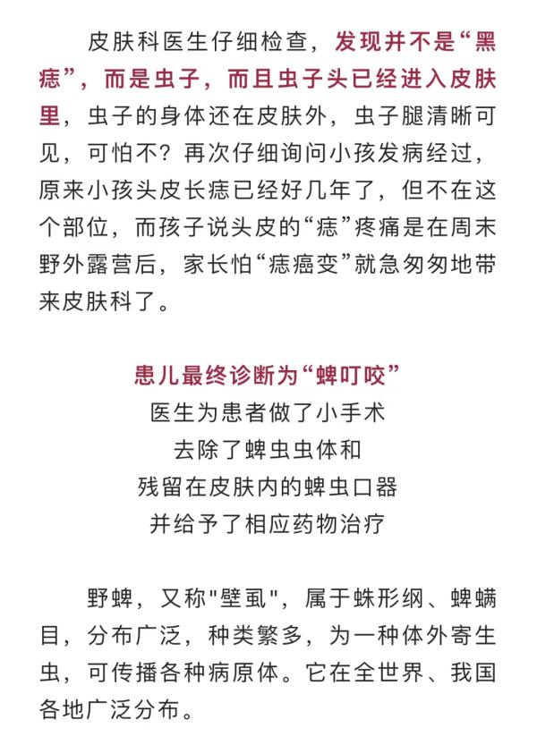 重要提醒！西安市民周末露营后，孩子头上的“黑痣”突然长大了，一查竟是……