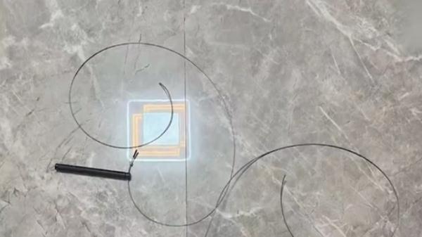 女子为减肥每天跳绳4千下，结果跳进了手术室