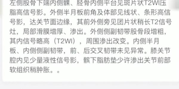 女子为减肥每天跳绳4千下，结果跳进了手术室