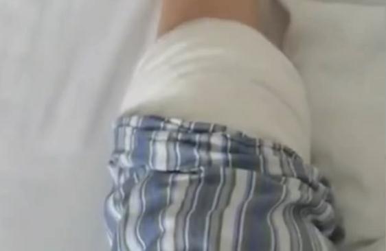 女子为减肥每天跳绳4千下，结果跳进了手术室