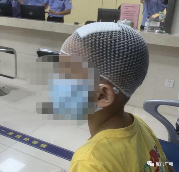 突发!厦门6岁男童被砸,头破血流!金属板从天而降......监控实拍! 突发!厦门6岁男童被砸,头破血流!金属板从天而降......监控实拍!