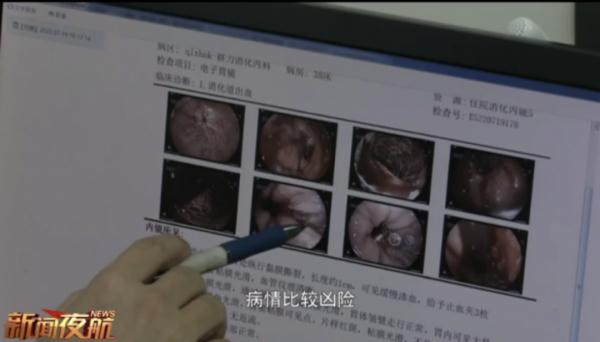 男子一口气喝完冰红茶后狂吐1000毫升血！夏季多发，医生提醒......