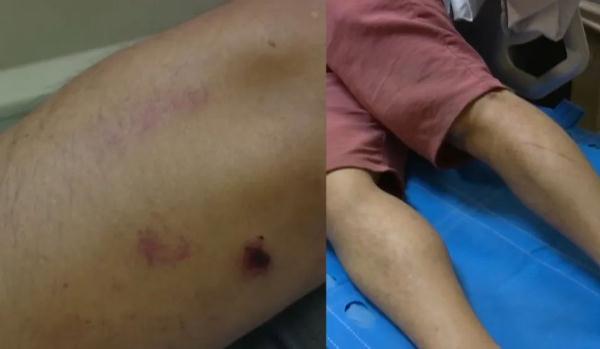 男子去医院看病人,没想到自己也成了病人!更气的是…… 男子去医院看病人,没想到自己也成了病人!更气的是……