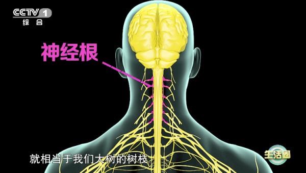 脖子僵硬你以为是吹空调吹的?注意!可能是这里病了 脖子僵硬你以为是吹空调吹的?注意!可能是这里病了