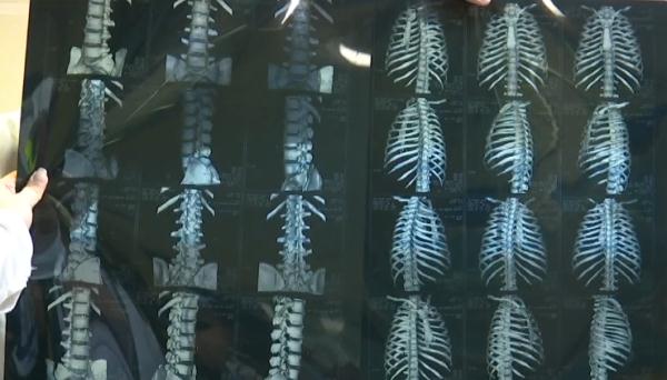 男子去医院看病人,没想到自己也成了病人!更气的是…… 男子去医院看病人,没想到自己也成了病人!更气的是……