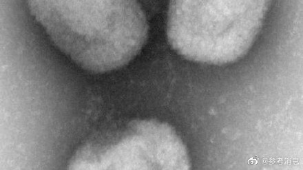 日媒：日本发现首例猴痘病例