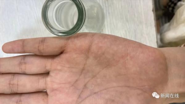 小孩喝牛奶感觉有异物，竟吐出一块玻璃碎渣……