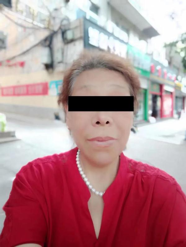 6旬阿姨相貌变得“五大三粗”，一查竟是这个原因……