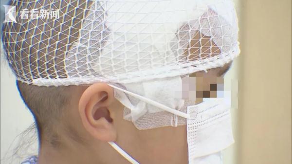 揪心！沪一5岁女童从床上跌落，剪刀插入颅内...