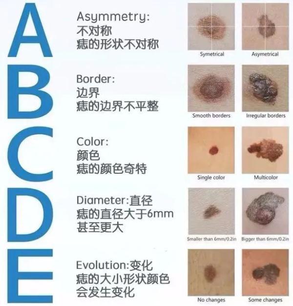 黑色素瘤会长毛吗图片