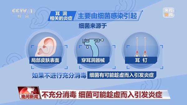 打耳洞竟引发颅内感染？这些问题一定要注意！