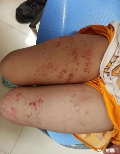 男孩在海边游泳突遭“电击”！原因是……