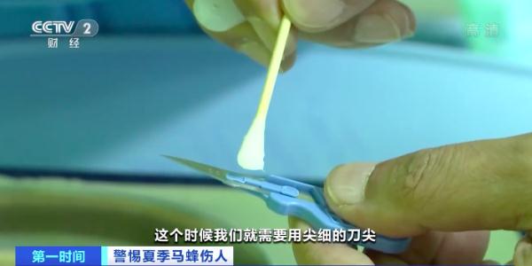 警惕！被马蜂蜇或致急性肾功能衰竭 医生紧急提醒