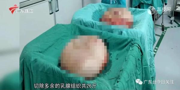 女子乳房两年内从B杯→Q杯！这种病症恐会影响生命
