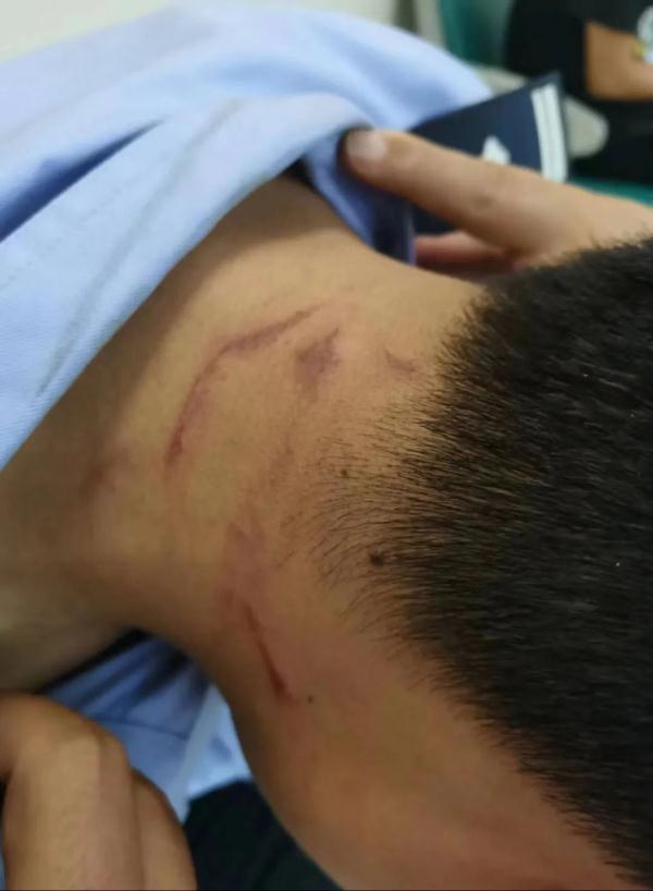 暴力袭警！拘留！