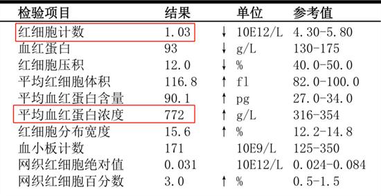 男子一吹空调体内血液就凝了