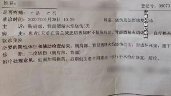银川女子养生店拔罐 ，造成二度烧伤！
