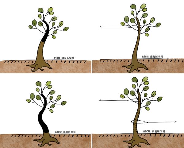 快摸摸孩子的脊柱，看看有没有侧弯！