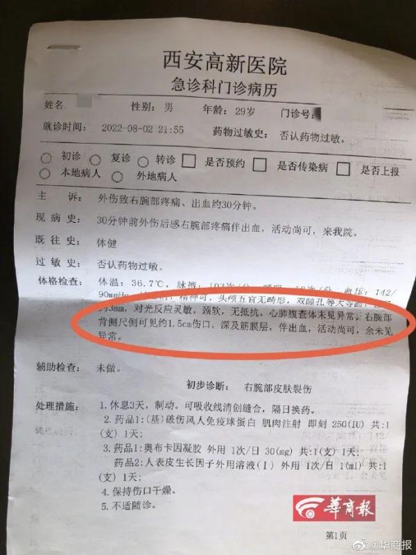“密室逃脱”时,手腕被同伴所持道具划伤,谁担责? “密室逃脱”时,手腕被同伴所持道具划伤,谁担责?