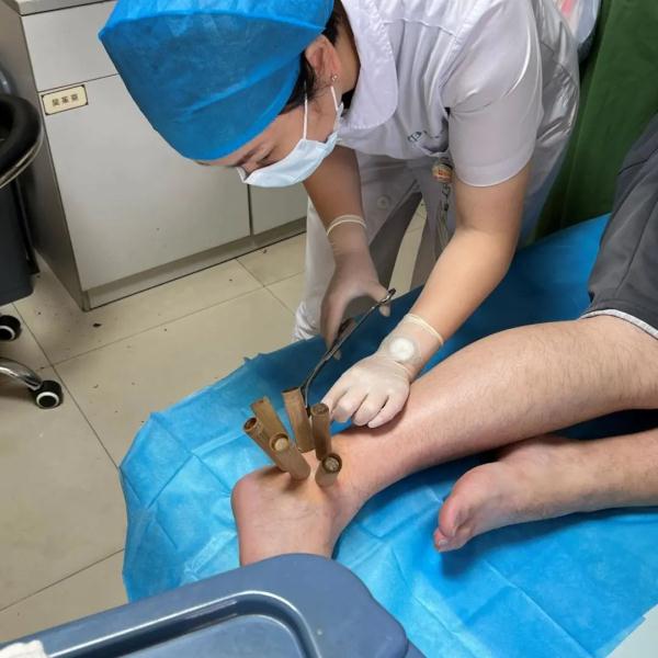 吓人！27岁小伙饮料当水喝，手脚都变形了！医生提醒