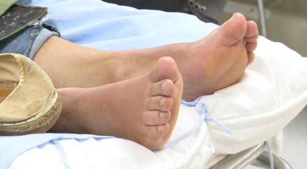 被“小个子咬到”头晕、浑身瘙痒疼痛、呼吸困难！其实它是......