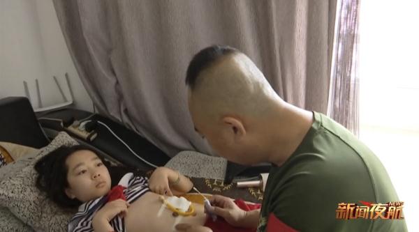 靠注射器吃饭的佳木斯13岁女孩伊伊迎来第一次手术......